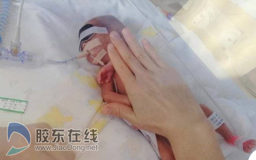 胎龄仅25周零6天！烟台山医院成功救治极早早产双胞胎